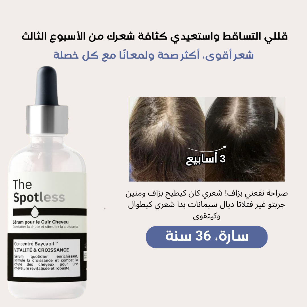 Spotless Hair Serum : تقوية طبيعية للشعر وتقليل التساقط مع نتائج واضحة من الأسبوع الثالث